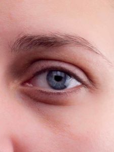 Auge vorher Auge vorher