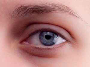 Auge vorher Auge vorher
