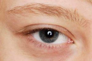 01 Vorher2 300x200 Blaues Smokey Eyes Augen Make up schminken