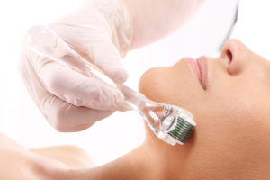 Microdemabrasion Microneedling Dermaroller