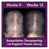 Regaine für Frauen