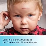 Bepanthen Narben Gel