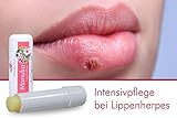 Manuka Lippenpflege bei Herpes