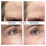 VITAYES Instant Ageback - Anti Aging Creme